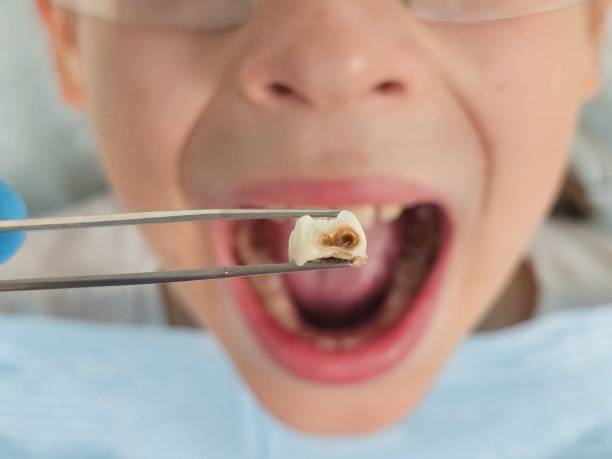 Best Broken Tooth Emergency  in North Riverside, IL